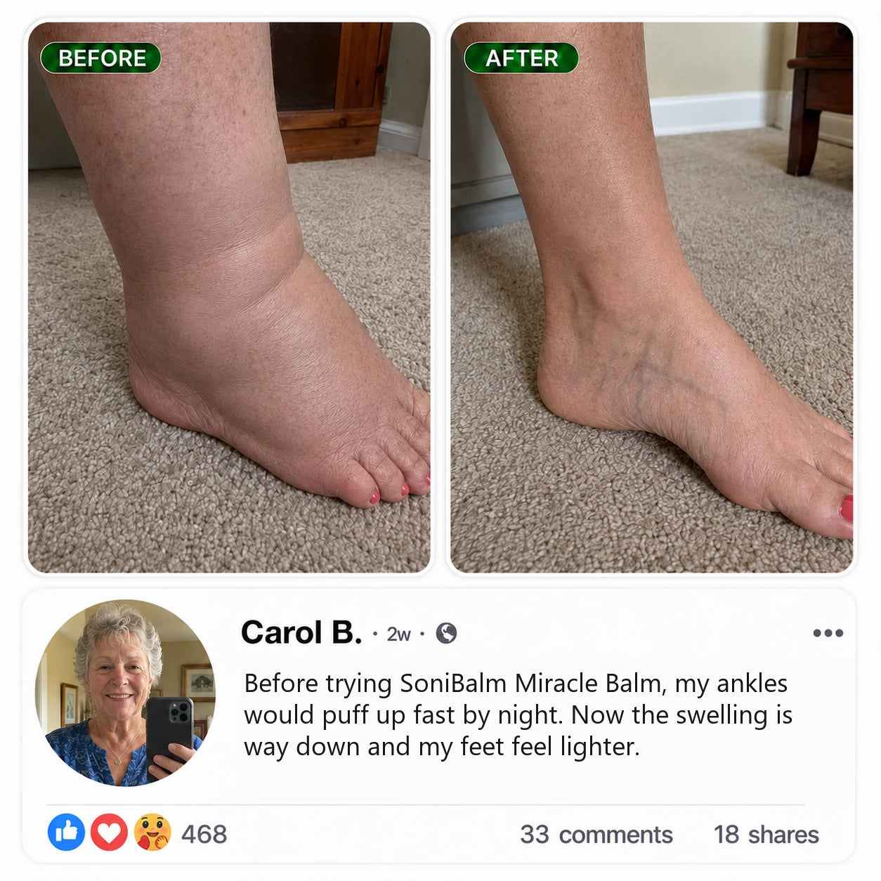 Before and after using SoniBalm, Carol B.